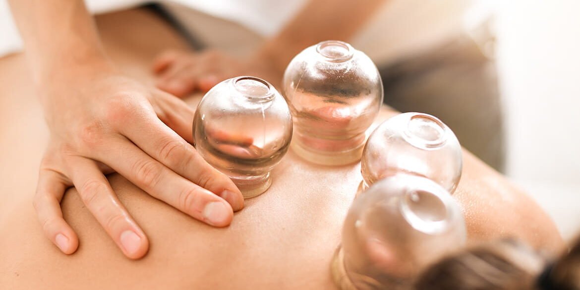 Cupping Therapy Cupping Therapy