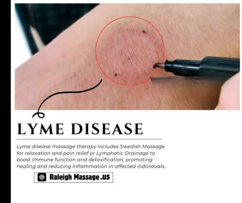 Lyme Disease and Massage
