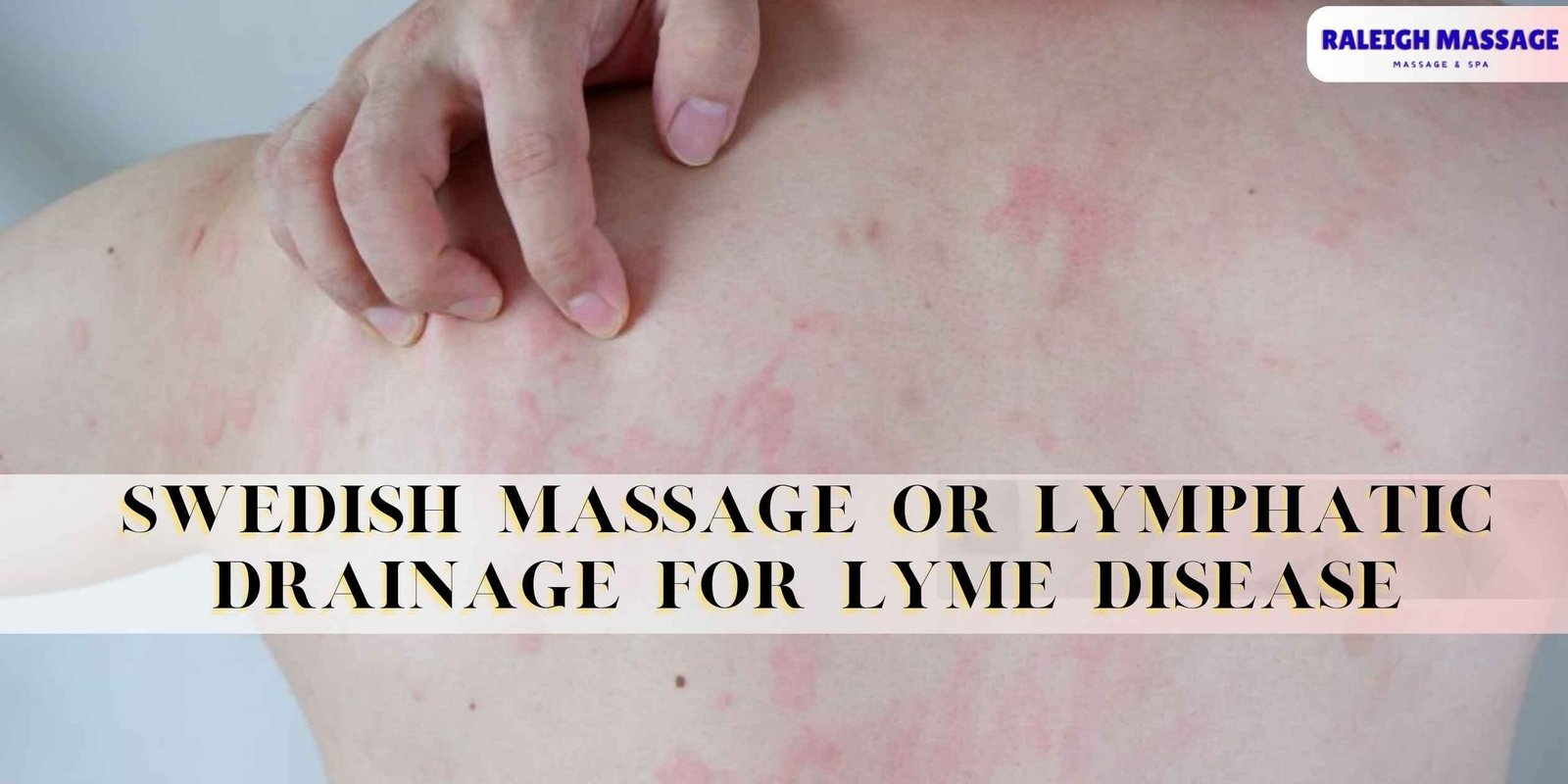 Swedish Massage or Lymphatic Drainage for Lyme Disease Swedish massage or lymphatic drainage for Lyme disease