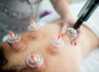 Cupping Massage