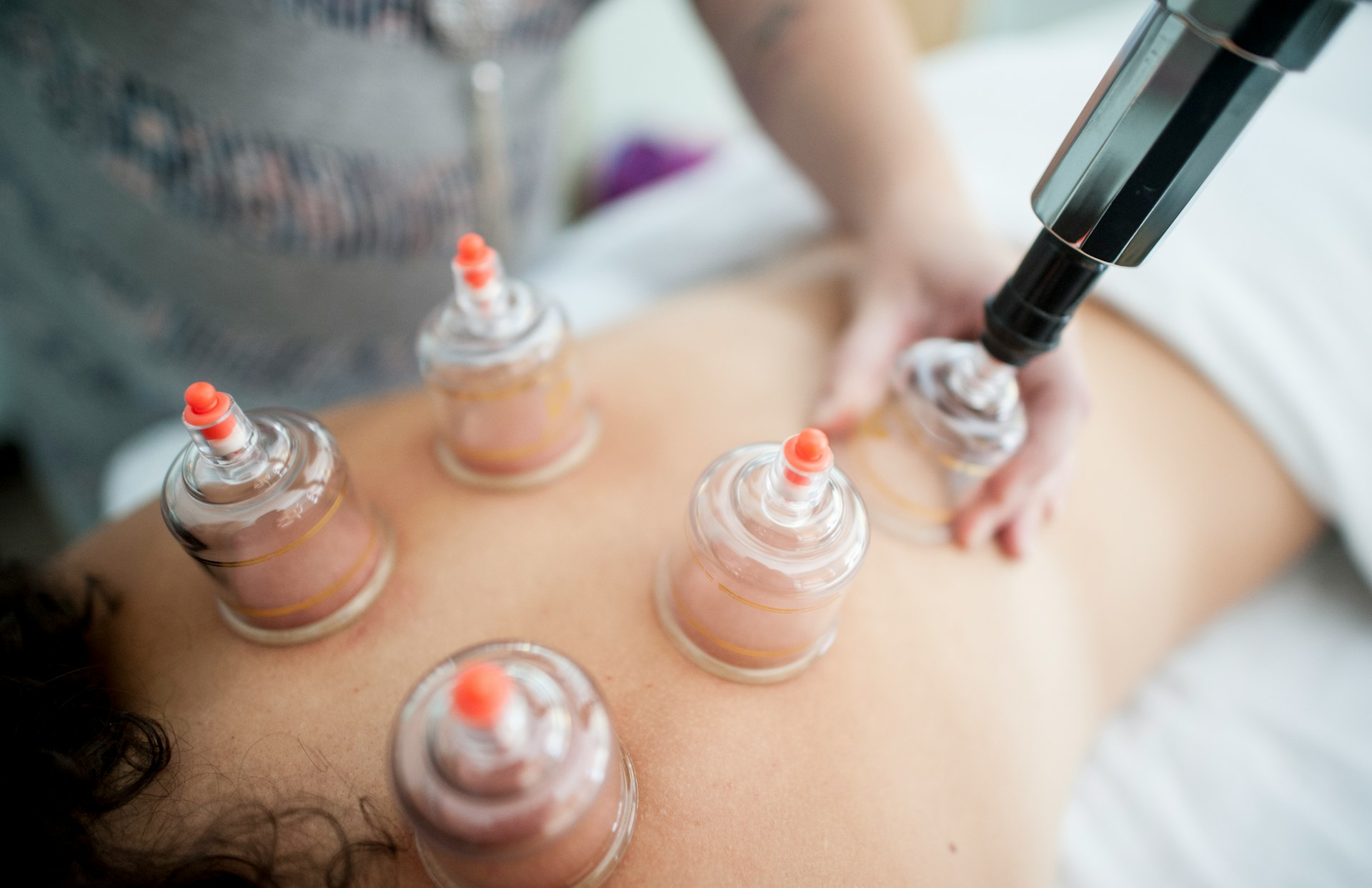Cupping Massage